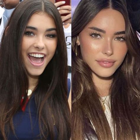 madison beer before plastic|Madison Beer Plastic Surgery: Quotes, Before, After Photos